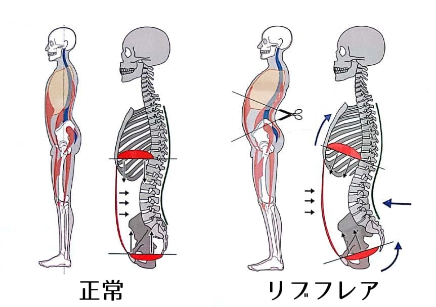 リブフレア